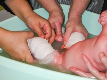 soaking a baby's casts off