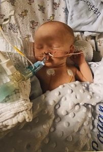 Baby logan in ICU supported by equipment 